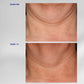 Neck Complex
