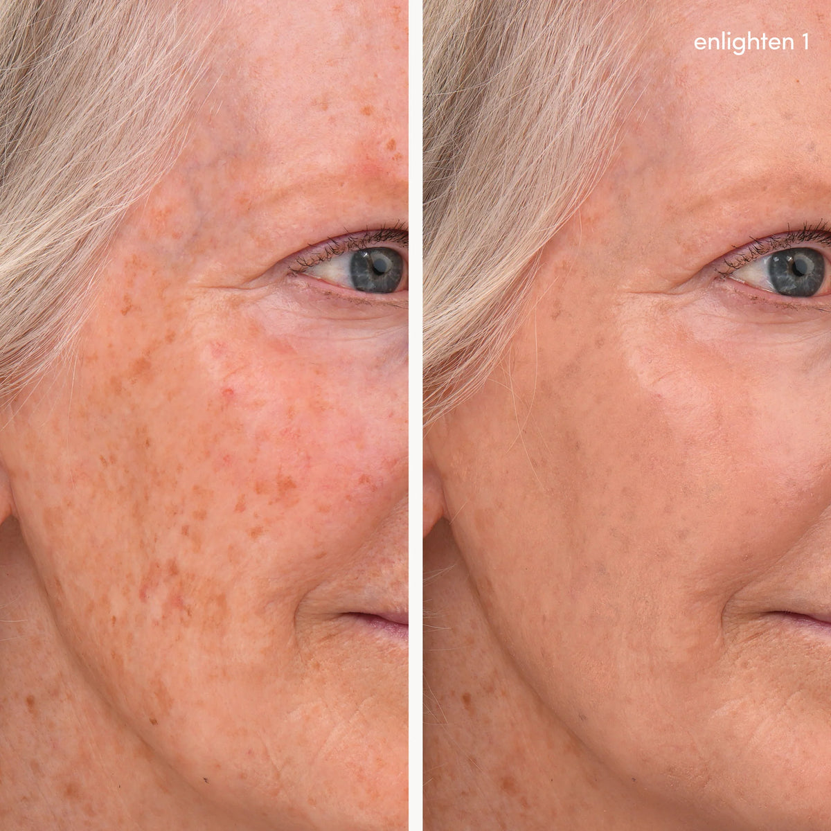 Enlighten Concealer